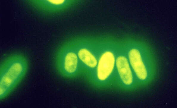 Schizosaccharomyces pombe