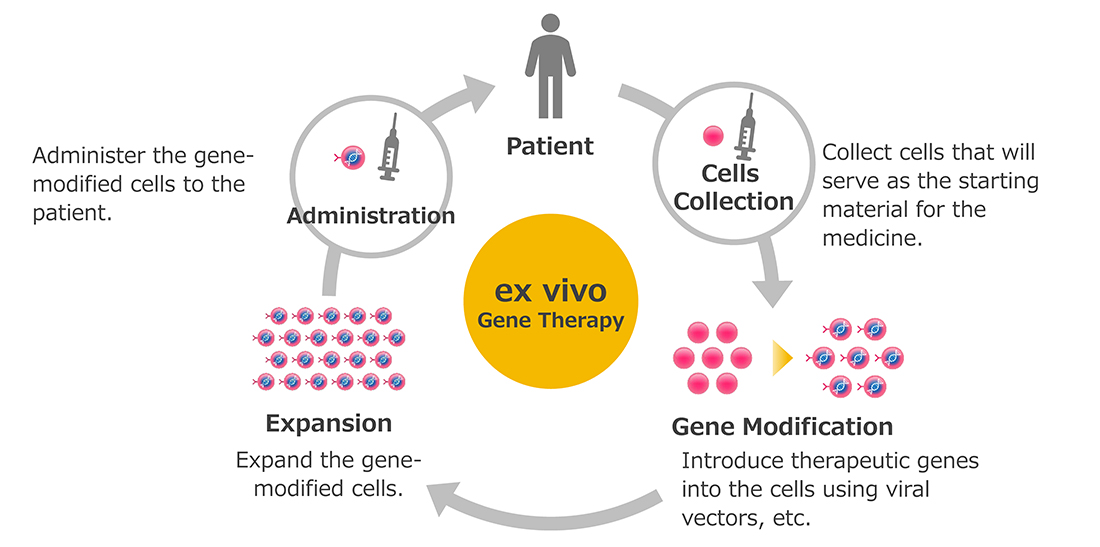 Image of ex vivo gene therapy