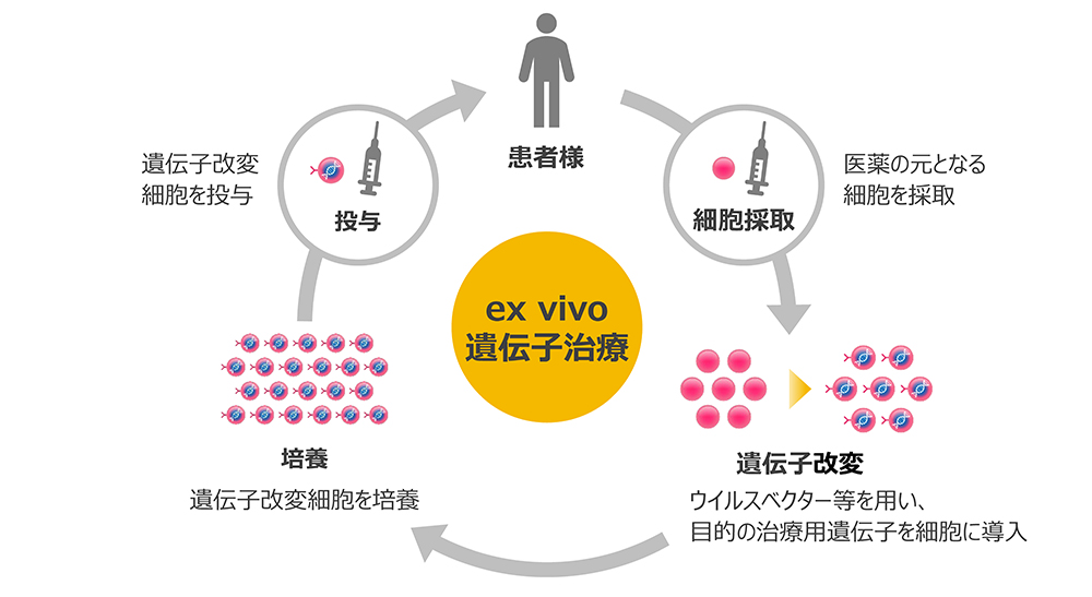 ex vivo遺伝子治療イメージ
